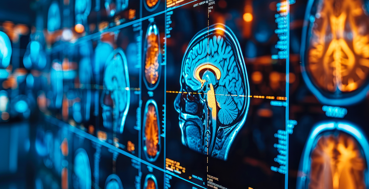 Missing alt text value