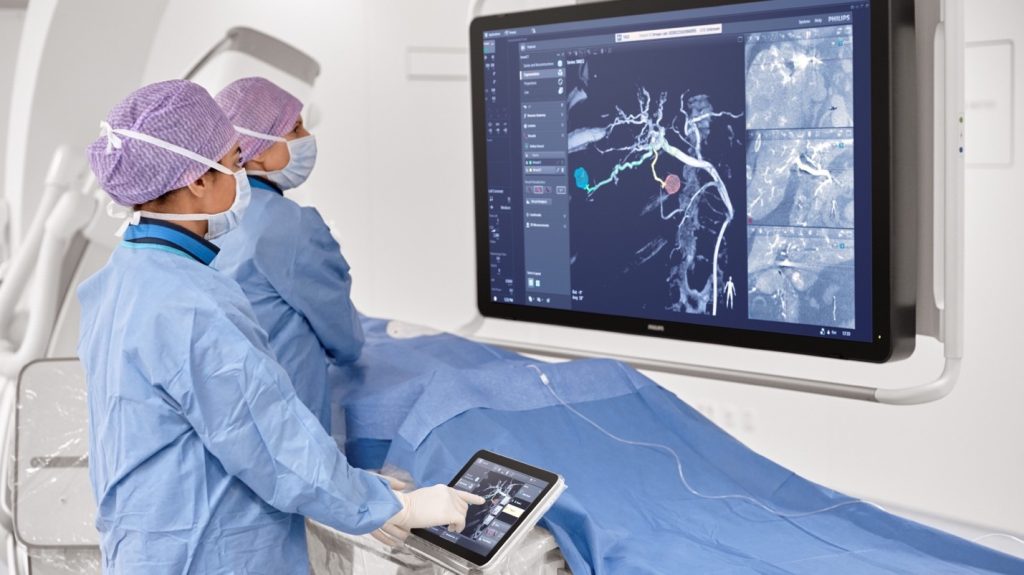 Two surgeons in sterile scrubs analyzing medical imaging on a large wall-mounted monitor
